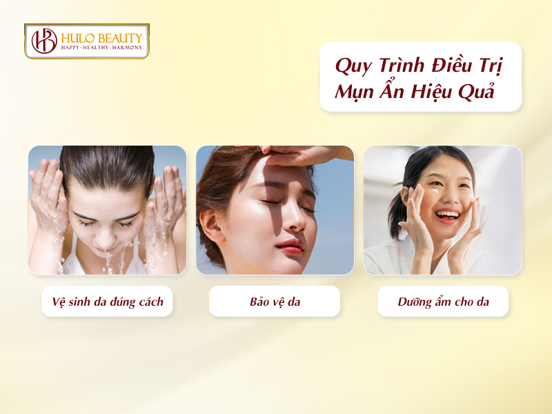 Quy trình điều trị mụn ẩn hiệu quả