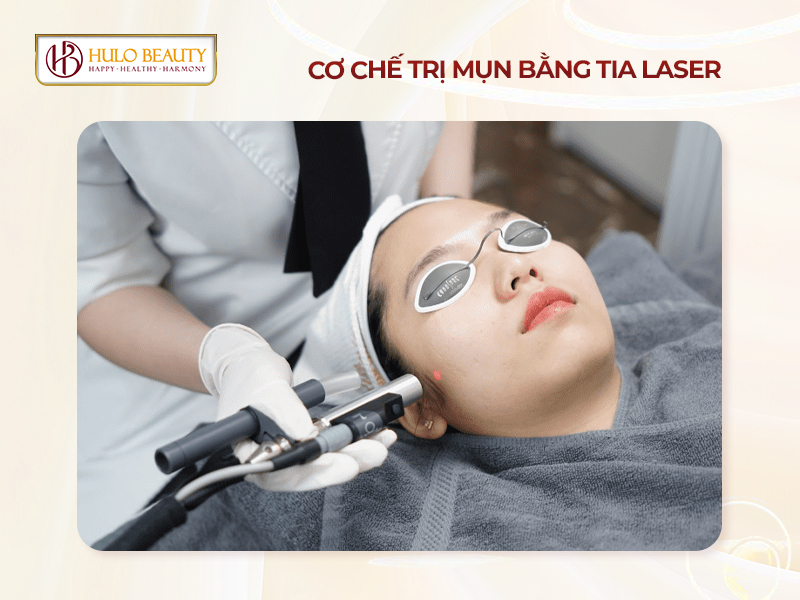 Cơ chế trị mụn bằng tia laser