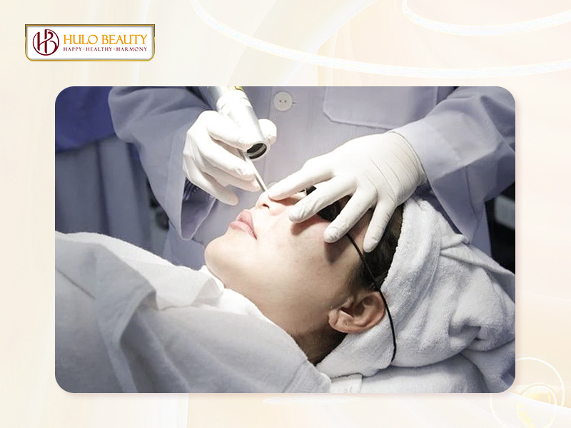 Ưu nhược điểm của điều trị mụn bằng laser