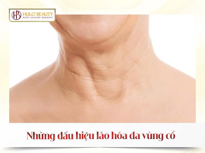 Những dấu hiệu lão hóa da vùng cổ