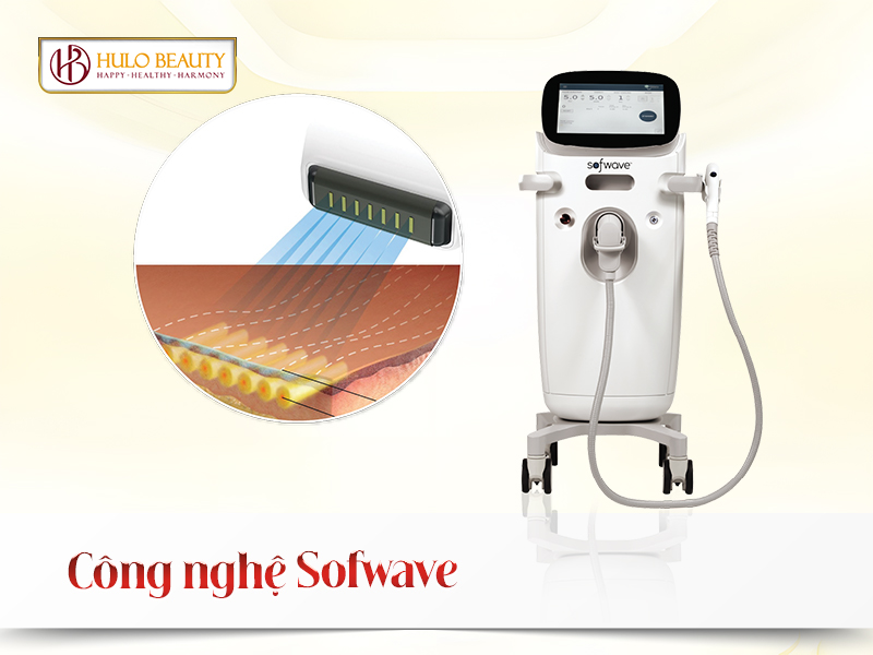 Công nghệ Sofwave
