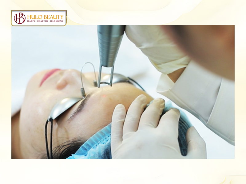 Laser Pico là công nghệ điều trị thẩm mỹ mang lại hiệu quả cao