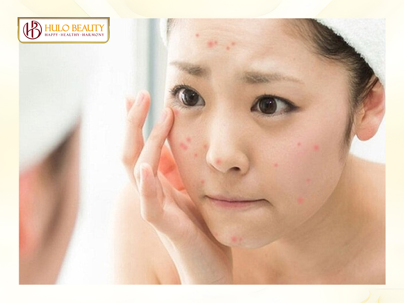 Da tuổi 20 có thể gặp phải một số vấn đề