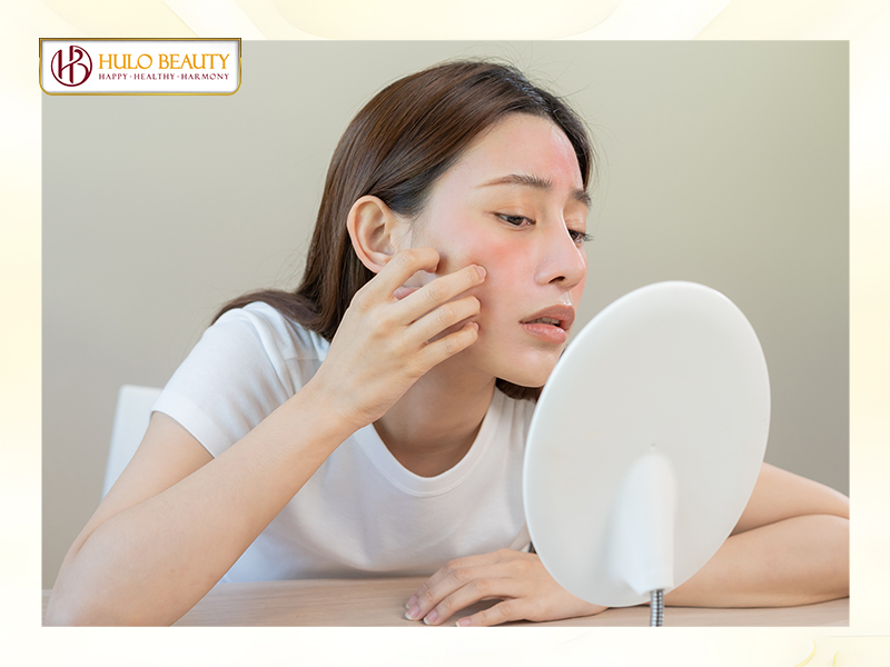 Tránh sử dụng các sản phẩm gây kích ứng