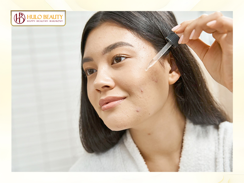 Hoạt chất trị mụn là gì?