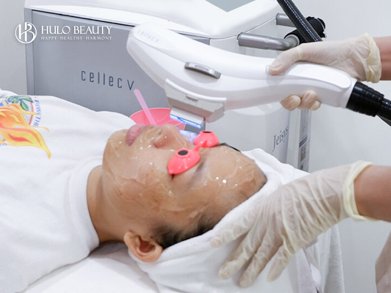 Bước 4: Chiếu IPL